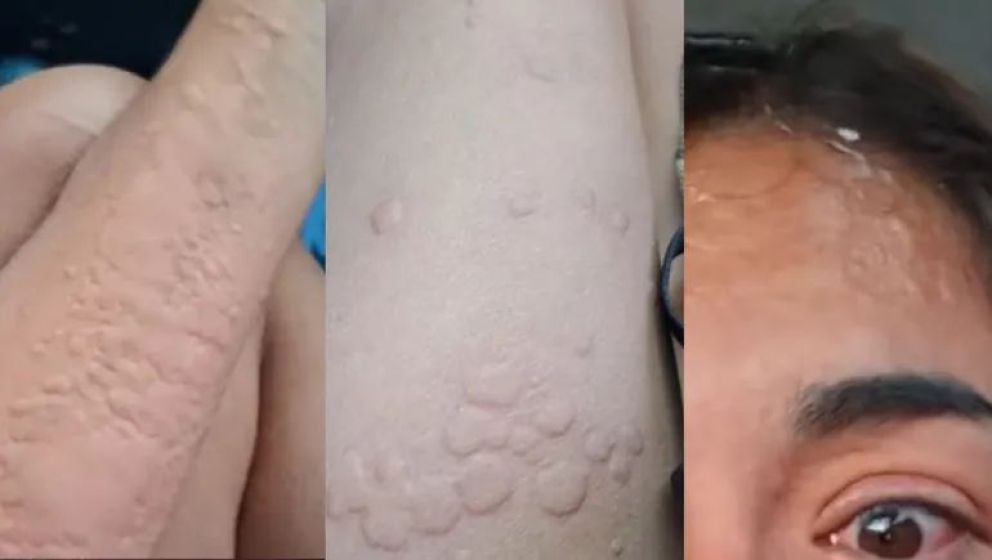 Alerta por chaquetas amarillas: el caso de una turista reaviva los consejos de prevención en la región