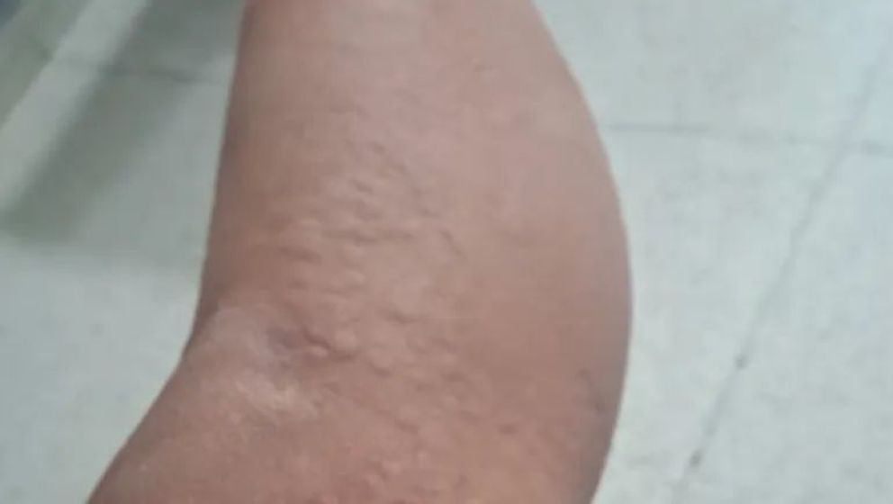 Alerta por chaquetas amarillas: el caso de una turista reaviva los consejos de prevención en la región